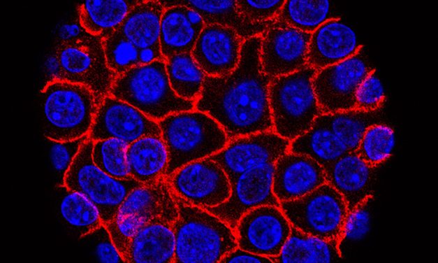 Experimental pill promises new hope for deadly pancreatic cancer